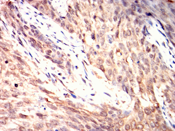 ATF2 Antibody