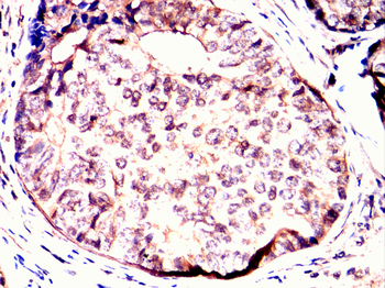 ATF2 Antibody