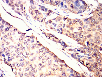 MAP2K6 Antibody