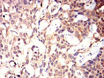 MAP2K6 Antibody