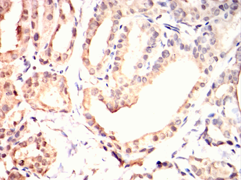 MAP2K6 Antibody