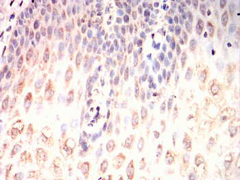 MAP2K4 Antibody