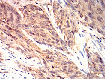 MAP2K4 Antibody