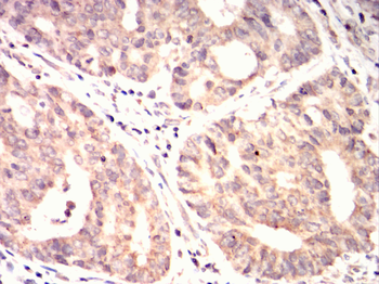 CRTC3 Antibody