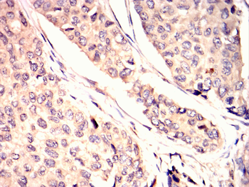 GRK2 Antibody