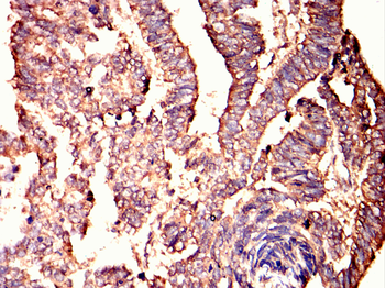 GRK2 Antibody