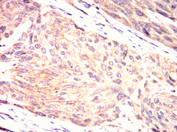 GRK2 Antibody
