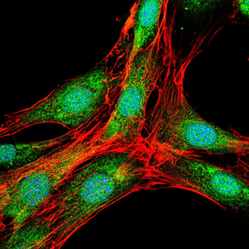 FYN Antibody