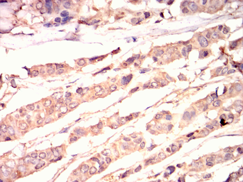 PDK1 Antibody