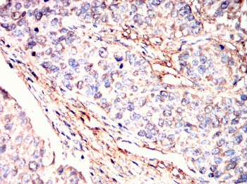 PDK1 Antibody