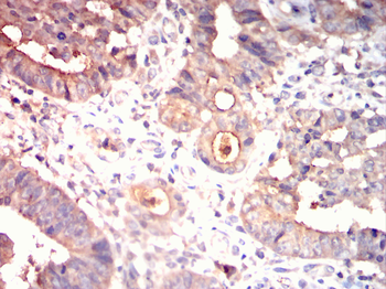 PDK1 Antibody