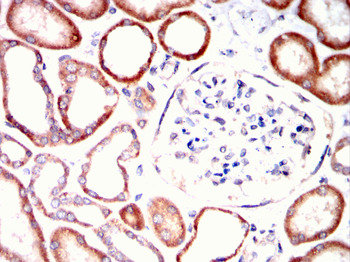 PDK1 Antibody