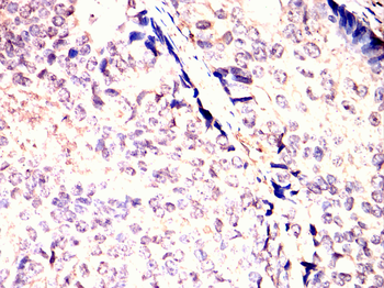 PDK1 Antibody