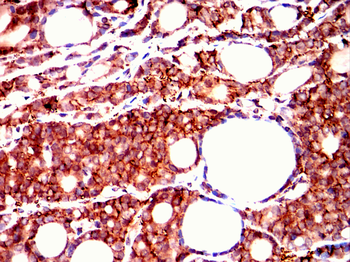 XRCC5 Antibody