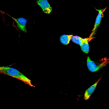 SMN1 Antibody
