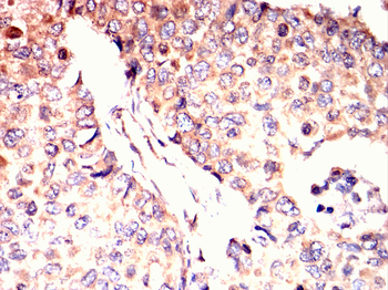 SMN1 Antibody