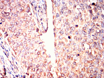 SMN1 Antibody