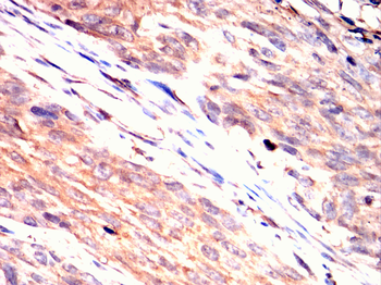 SMN1 Antibody