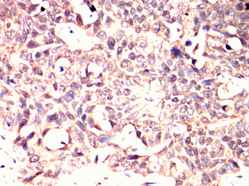 SMN1 Antibody
