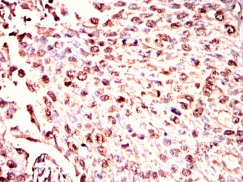 ISL1 Antibody