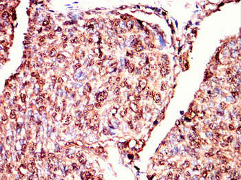 ISL1 Antibody