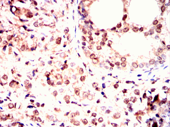 ISL1 Antibody