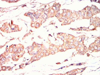 LDLR Antibody