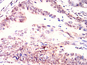 LDLR Antibody