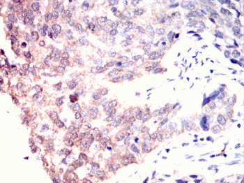 LDLR Antibody