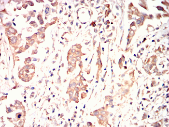 LDLR Antibody
