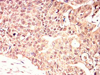 LDLR Antibody