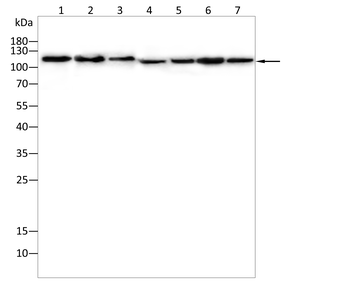 LDLR Antibody