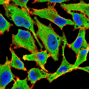 COL17A1 Antibody