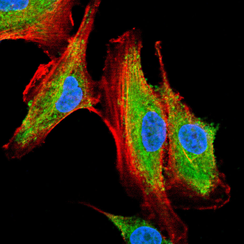CPT2 Antibody