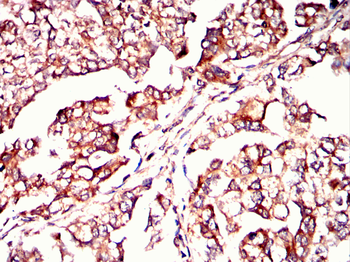 CPT2 Antibody