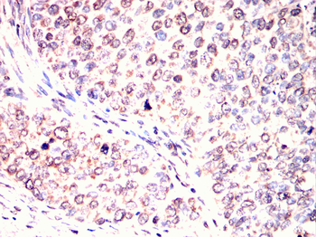 CPT2 Antibody