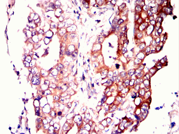 CPT2 Antibody