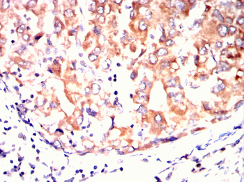 CPT2 Antibody