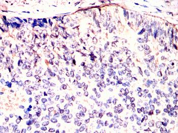 CPT2 Antibody