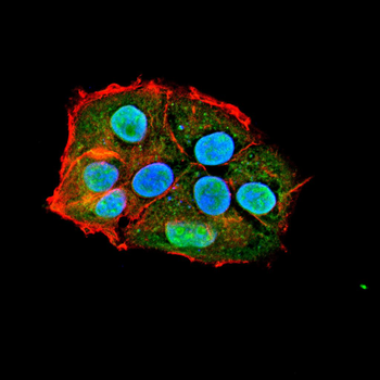 IGF2R Antibody