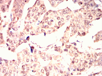 IGF2R Antibody