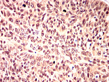 IGF2R Antibody