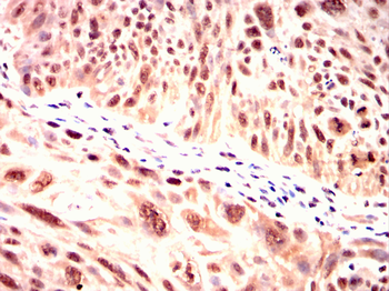 IGF2R Antibody