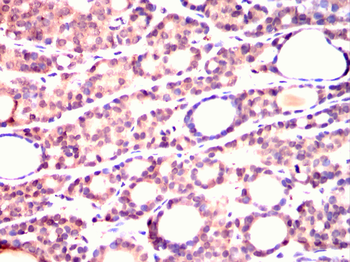 IGF2R Antibody