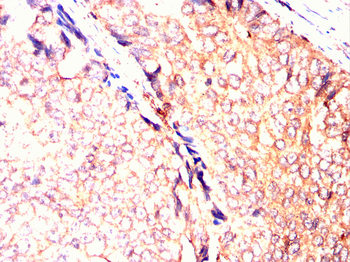 OLIG2 Antibody