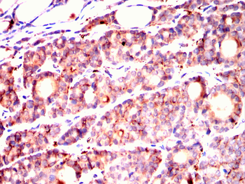 OLIG2 Antibody