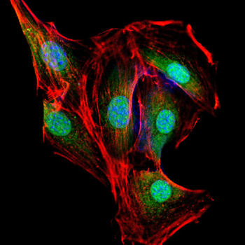 CHEK1 Antibody