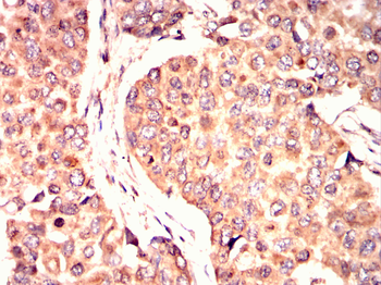 CHEK1 Antibody