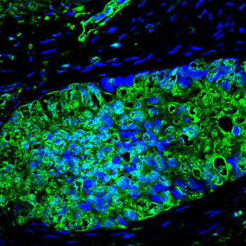 CHEK1 Antibody