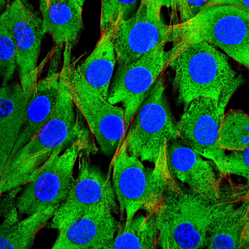 PDGFRA Antibody